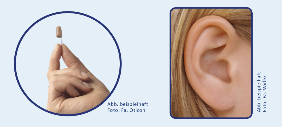 Im-Ohr-Hörgerät